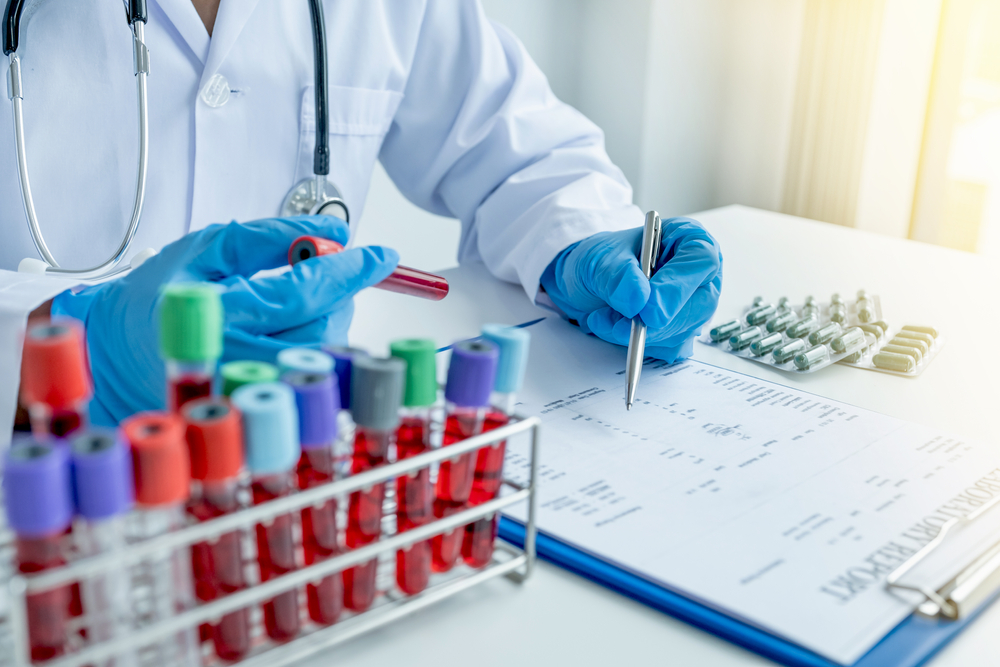 Check-Up'ta Yapılan Kan Testlerin ve Kısaca Anlamları
