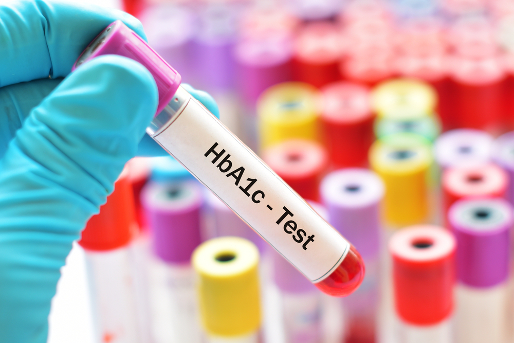 HBA1C Testi Nedir?