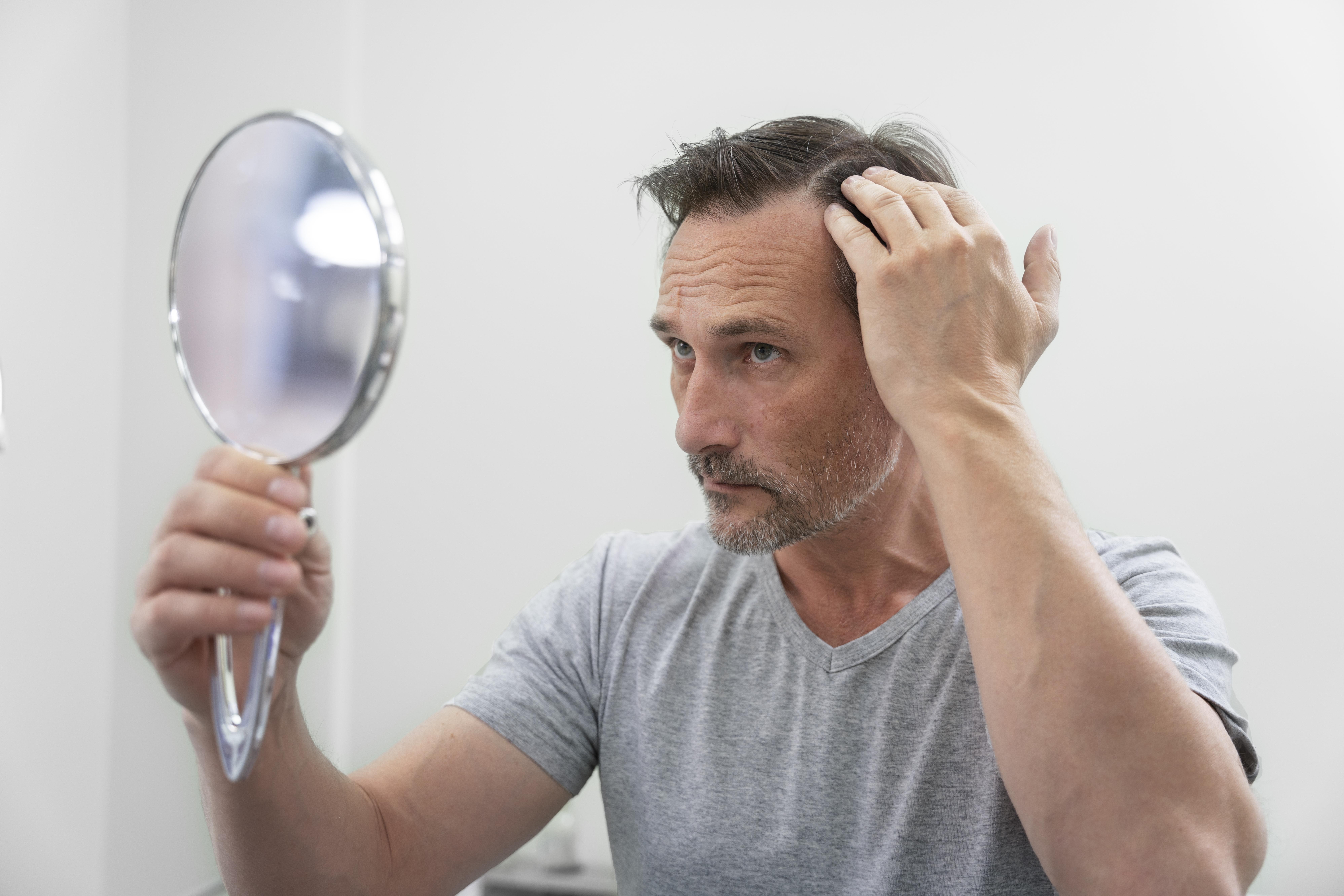 Saç Ekimi Tedavisi Nasıl Planlanır?