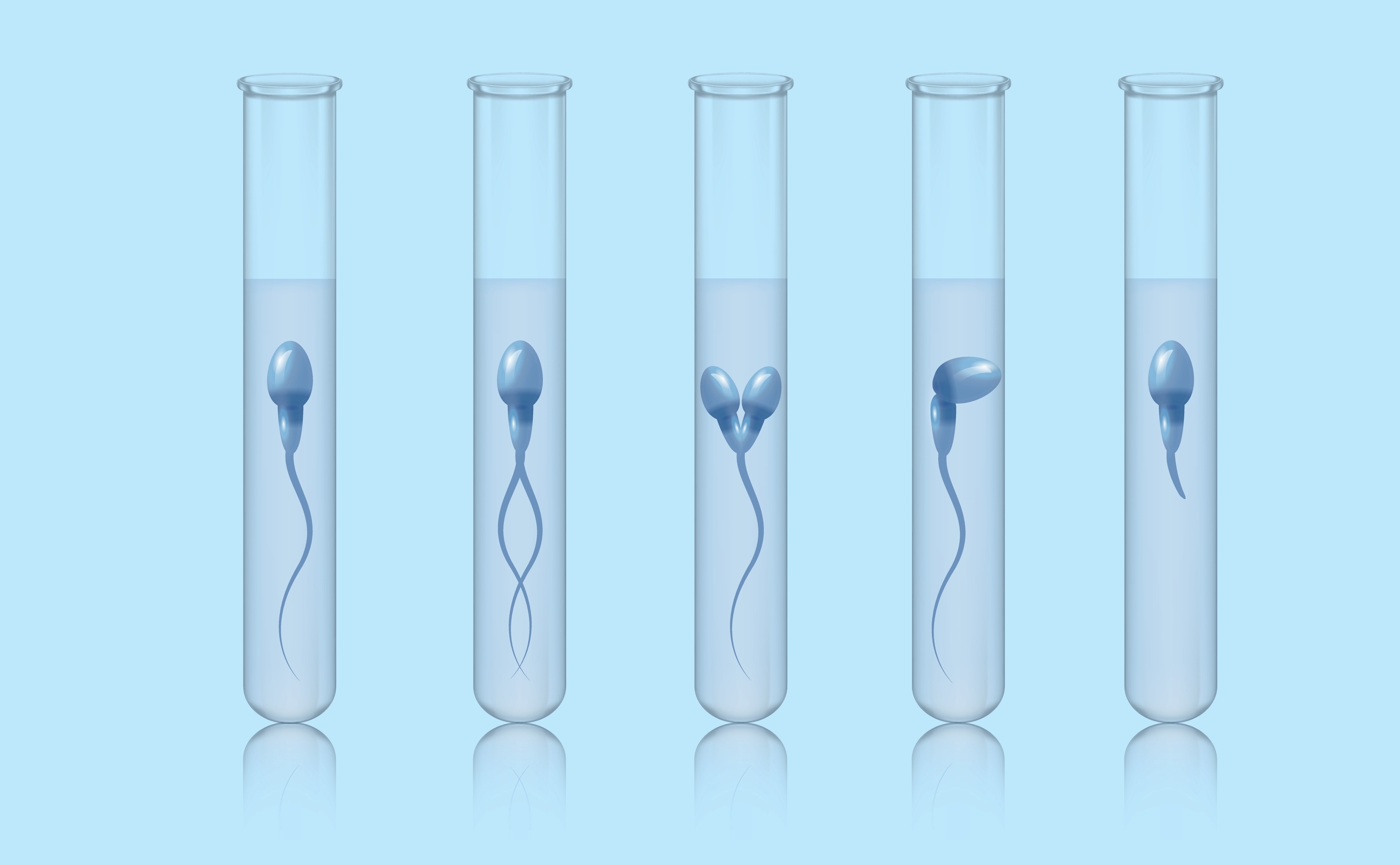 Spermiogram (Sperm Testi) Hakkında Bilmeniz Gerekenler